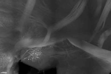 A white-stained cluster of amyloid plaque proteins, a hallmark of Alzheimer's disease pathology, is evident in the mammillary body of a 2-month-old Alzheimer's model mouse. A new study finds that plaques begin in such deep regions and spread throughout the brain along specific circuits.