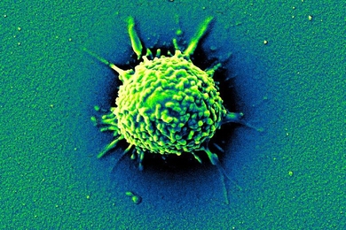 White blood cells are among the first to mount an attack against sepsis, a deadly complication of Covid-19. In a project led by MIT Professor Daniela Rus, researchers are developing a machine learning system to detect an activated immune response to sepsis which could lead to earlier, more aggressive treatment. Here, a white blood cell attacks malaria.