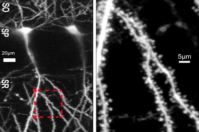 Within a microscope image of neurons from the hippocampus region of a rodent brain (left), a zoomed-in section (red square) of a neuron's dendrites shows spines (right) where many synaptic connections with other neurons reside.