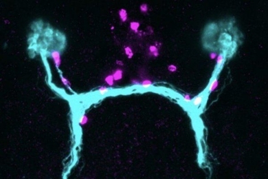 Fluorescent image of the visual system of the planarian Schmidtea Mediterranea. Visual axons and photoreceptor neurons shown in cyan, guidepost-like cells shown in magenta.