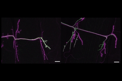 The left side shows a "tonic" neuron (stained green) growing to just one muscle on the right of the panel. In the next panel, one can see a "phasic" neuron (also stained green) connecting to more than one muscle.