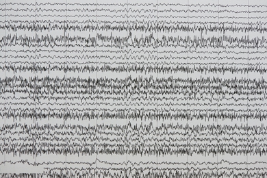 Dark, wavy lines representing brain cell activity stretch across a gray page.