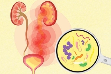 Stylized illustration of microbes in a urinary tract