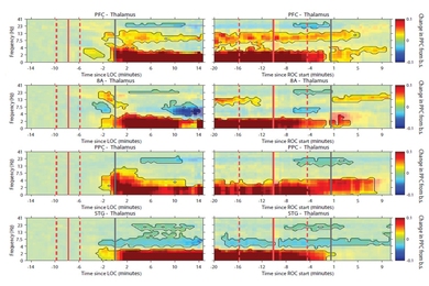 Eight horizontal images shows stripes of color moving across over a horizontal axis of time and a vertical axis of frequency.