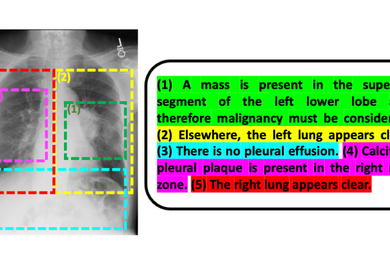Image of a chest radiograph with color-coded text annotations