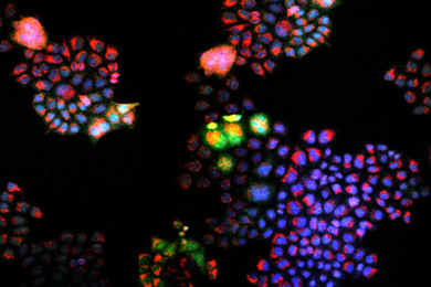 Photomicrograph of tumor samples, which appear as multicolored dots on a black background