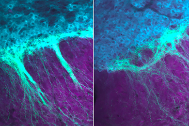Microscopic image of dopamine-producing neurons in the mouse midbrain