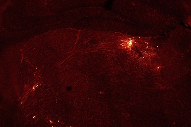 Isolated clusters of neurons glows yellow-orange over a dark background