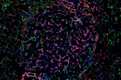 Against a black background, a multicolored mesh of biological tissue, arranged in a roughly circular shape