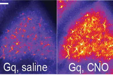 Individual neurons mix multiple RNA edits of key synapse protein, study  finds, MIT News