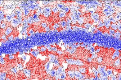 Colorized micrograph of brain tissue. A horizontal strip of tiny blue circles crosses the middle of the image, against a background of red and lighter blue cell-like shapes.