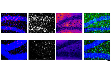 Ingestible electronic device detects breathing depression in patients, MIT  News