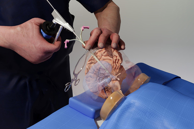 Photo of a virtual reality model of a surgeon's hands holding a medical device that looks like a long rod with a hand grip and trigger. He is inserting the rod into a transparent model of an infant's head and brain