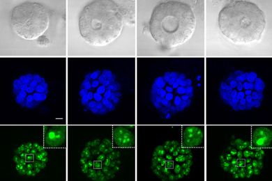 Three rows show a tumor responding to types of treatment. Top shows grey microscopic image of tumor. Middle row is stained blue and shows blue lumps. Bottom row is stained green and shows smaller bits.