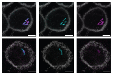 Tuberculosis bacteria