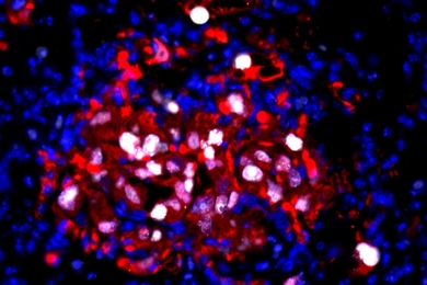 Micrograph with a cluster of red and some white spots amongst many blue spots.