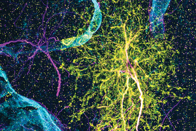 Microscope image of a star-shaped yellow neuron.